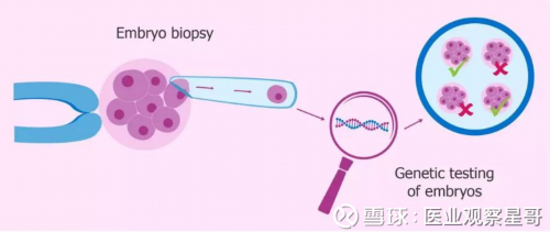 痛经期间注意什么,痛经会影响受孕吗
