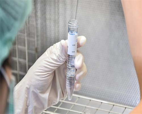 宫腔镜检查费用宫腔镜检查多少钱