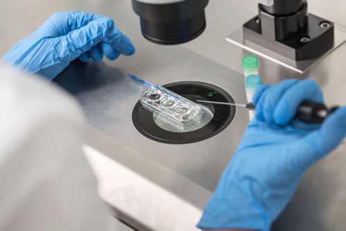 怀孕初期黄色分泌物