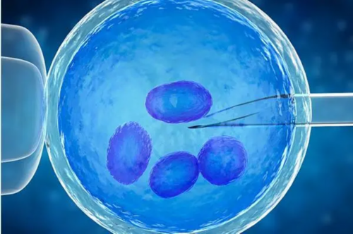 四维彩超比较佳时间是几周？,试管选性别