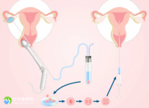   急性肾功能不全有什么症状