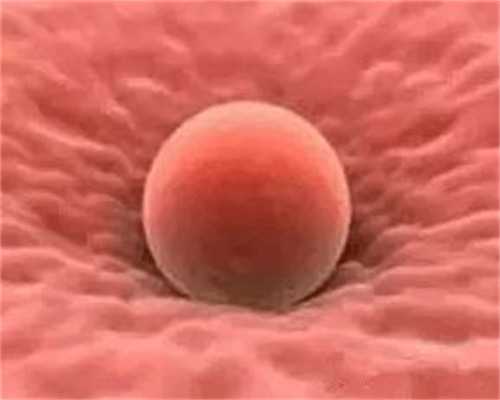 检查性激素六项需要空腹吗