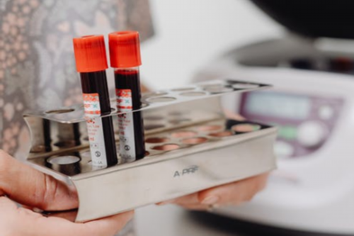 鞍山怀孕建档带什么资料-正规代生