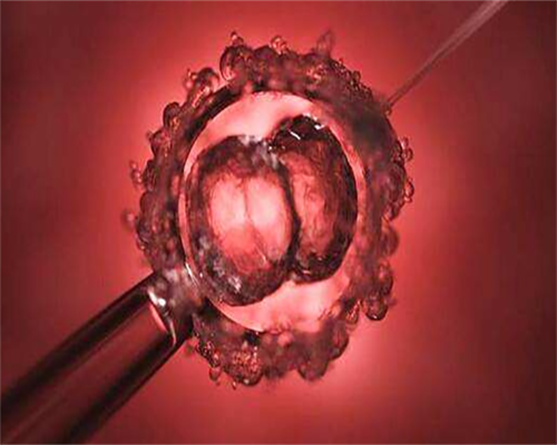 卵巢早衰是因为什么引起的呢