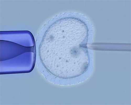 凭什么！南京代腹生子多少钱＂执牛耳＂