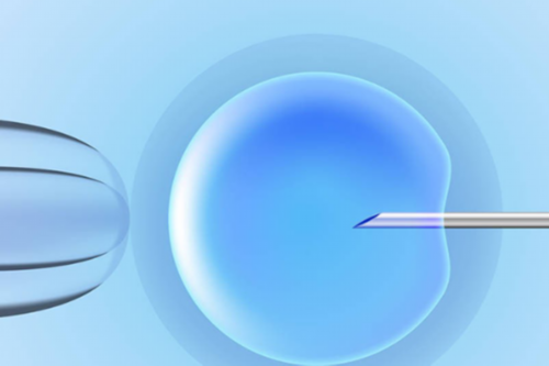 宫角妊娠手术后多久能怀孕-拉拉试管代怀