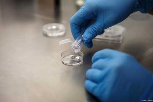 女人梦见奔跑的梅花鹿群是什么预兆？