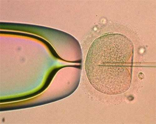 潮州子宫肌瘤饮食注意：子宫肌瘤术后饮食注意些什么,供卵不排队