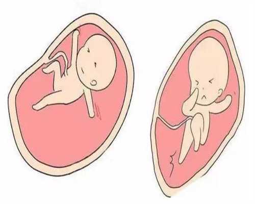 挑战！上海代孕哪家医院好＂天粟马角＂