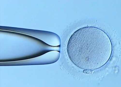 婴儿需要陪玩还是独处