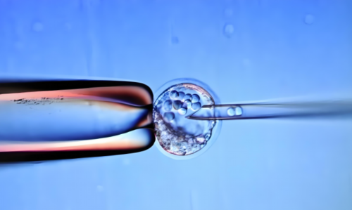 上环以后腿疼什么原因（上环疼吗）