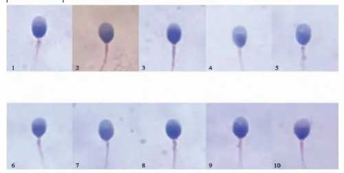患了胰岛素抵抗能吃火龙果吗