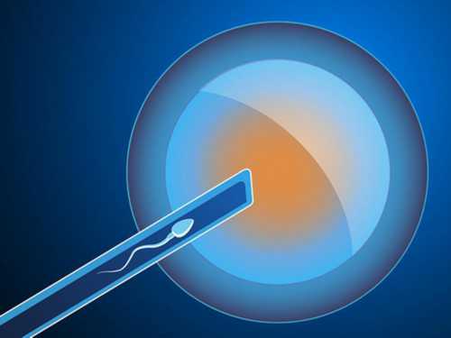 糖尿病影响做试管婴儿吗_糖尿病影响试管着床吗,失独代怀代生