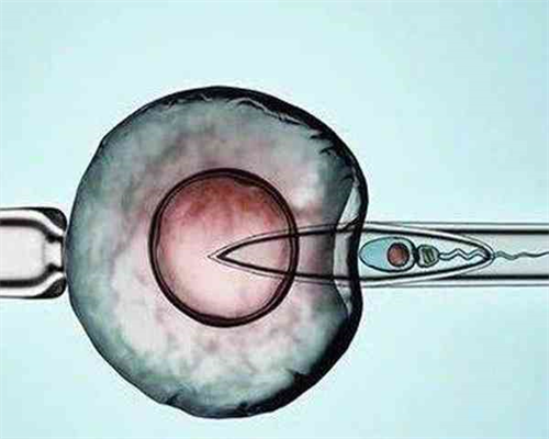 怎么看！三代试管上海集爱＂抹稀泥＂