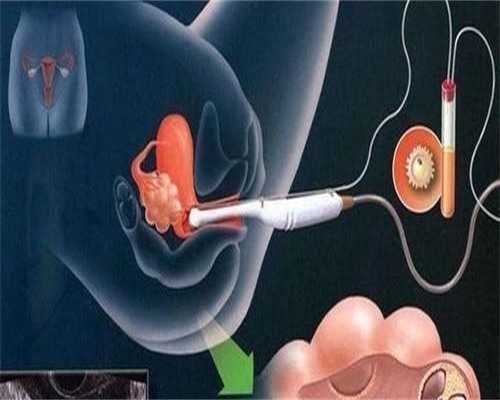 胚胎培养是什么？如何进行胚胎培养？-捐卵代生助孕