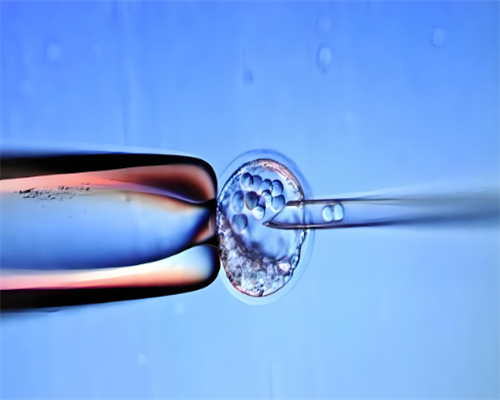 孕妇能吃三文鱼吗_吃三文鱼的好处_吃三文鱼的注意事项-私人试管代孕