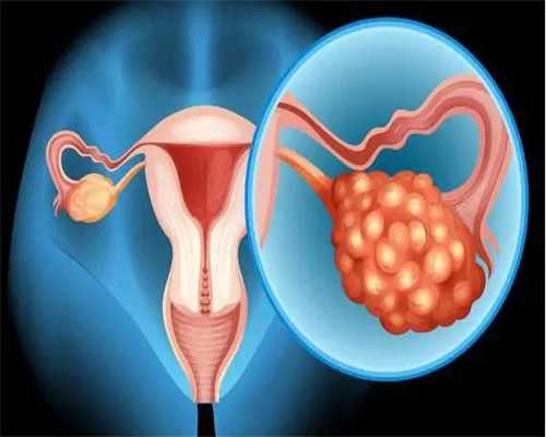 肾移植三个月内的饮食-生二胎找供卵