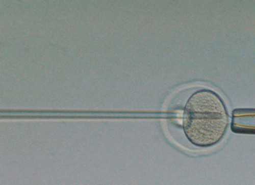 艾灸暖宫多久一个疗程 艾灸有什么禁忌吗-供卵医院在哪