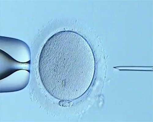 试管婴儿进入周期后移植需要多久？