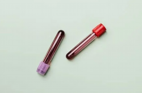 遗传性骨软骨瘤患者能结婚吗